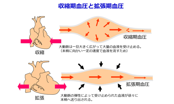 高血圧のリスク