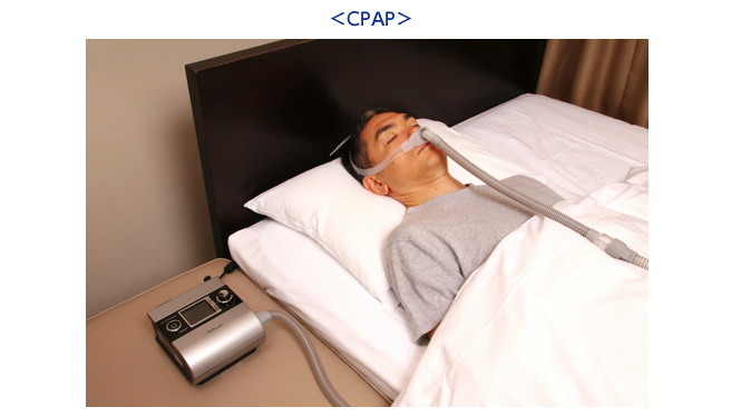CPAP治療