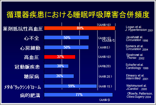 循環器疾患における睡眠呼吸障害合併頻度